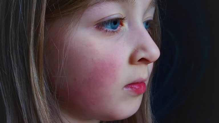 Aberdeenshire mum launches legal action against NHS Grampian over daughter's long COVID treatment